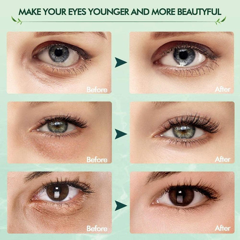 Os adesivos para os olhos Seaweed Firming Eye Mask são uma solução eficaz para tratar as rugas, bolsas escuras e olheiras ao redor dos olhos. - romsalti