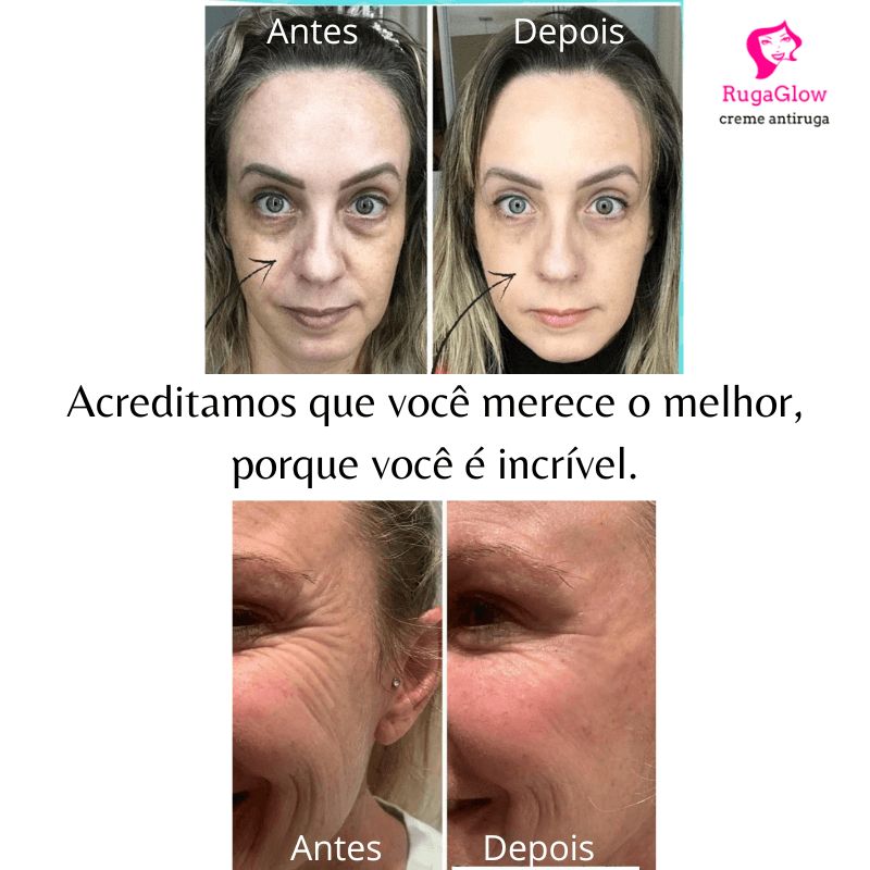 Creme Antirrugas e hidratação da pele RugaGlow®